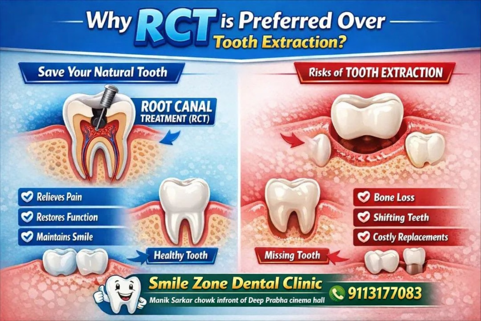 RCT Treatment Benefits